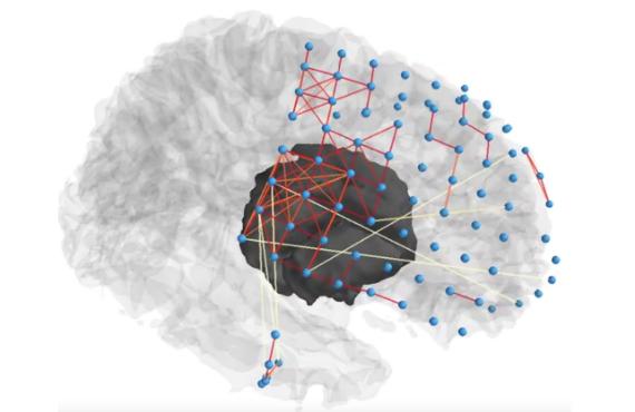 Brain Networks Predict Spread of Seizures
