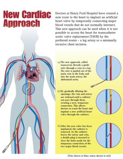 heart valve replacement surgery success