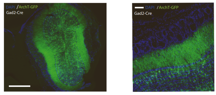 Researchers discover the mechanism responsible for information transfer between different regions of the brain