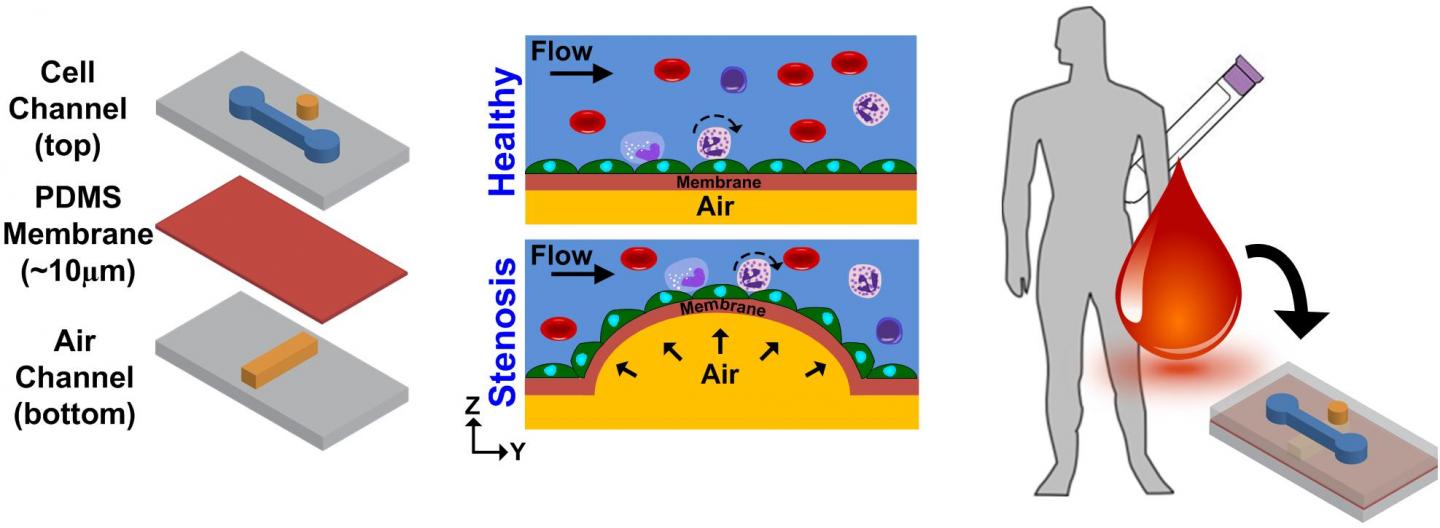 Atherosclerosis-on-a-chip Microdevice