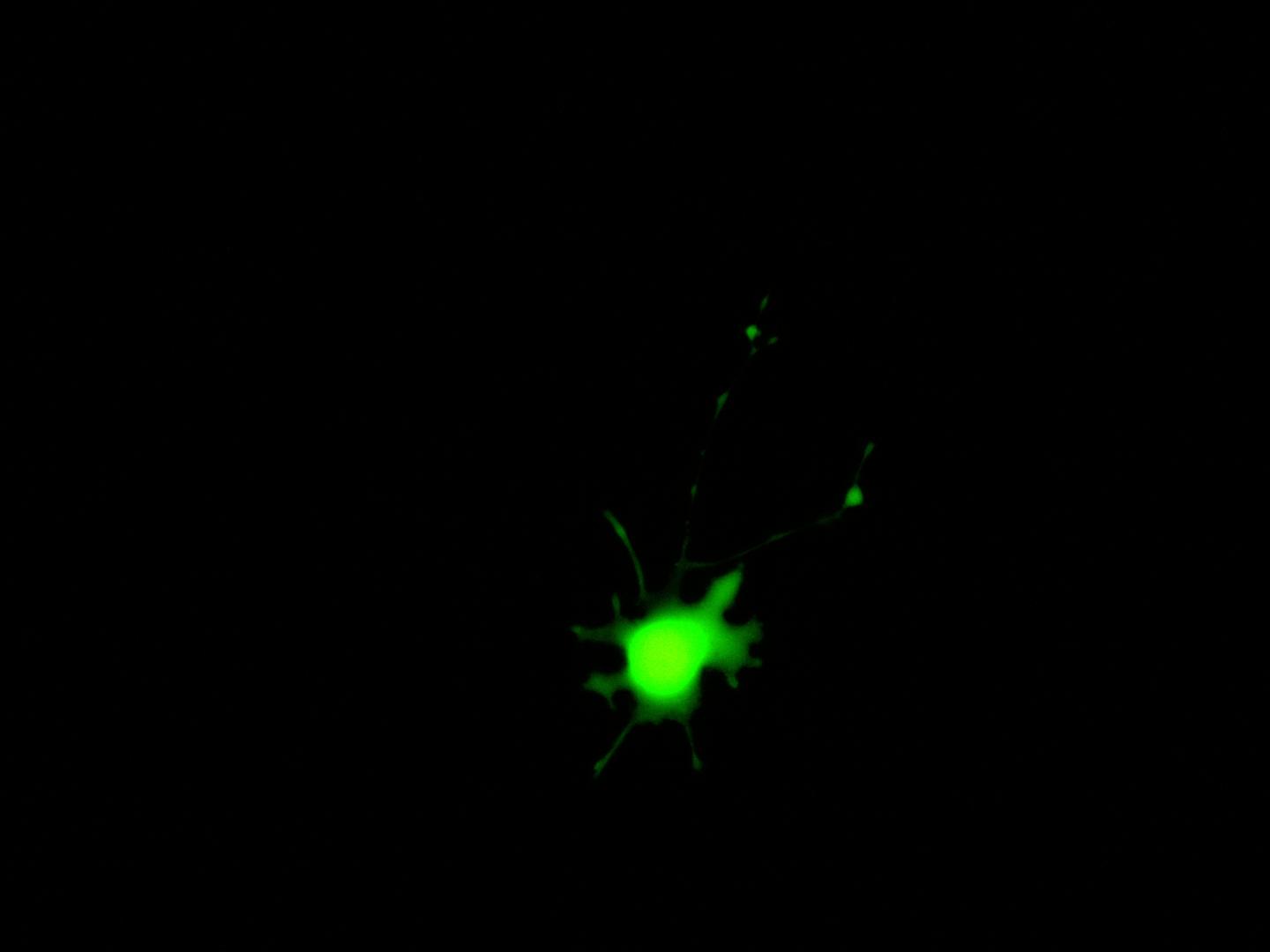Astrocyte infected with a modified version of SARS-CoV-2