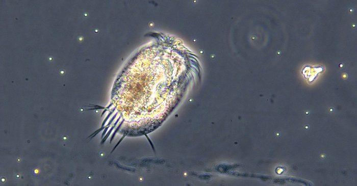 Protists such as this Euplotes are common in water, soil, even moss.