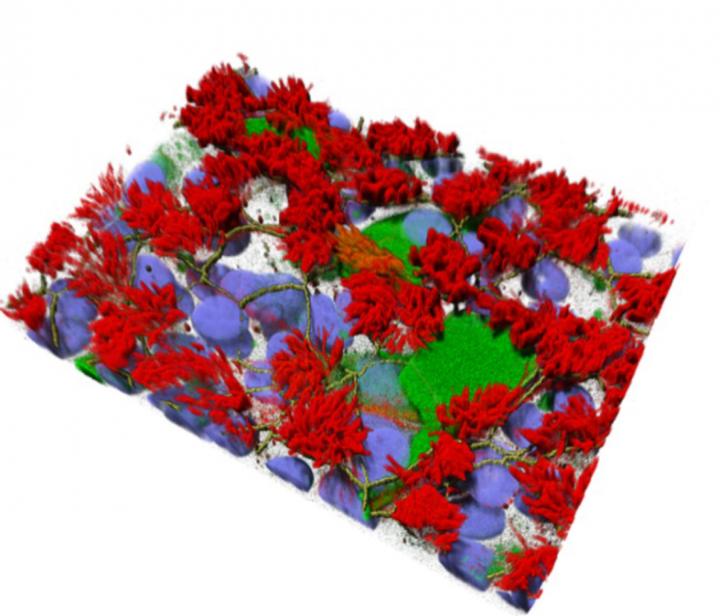 A 3D representation of human airway cell cultures that mimic the complexity of the cells found in the respiratory tract.