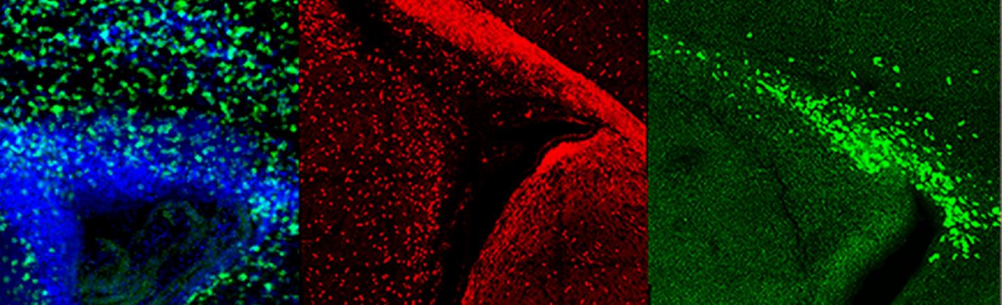 New Strategy Identifies Potential Drugs and Targets for Brain Repair