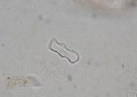 Phytolith from a Grass