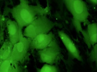 Chemical Probe Confirms Real-Time that Body Makes Its Own Rotten Egg Gas (1 of 2)