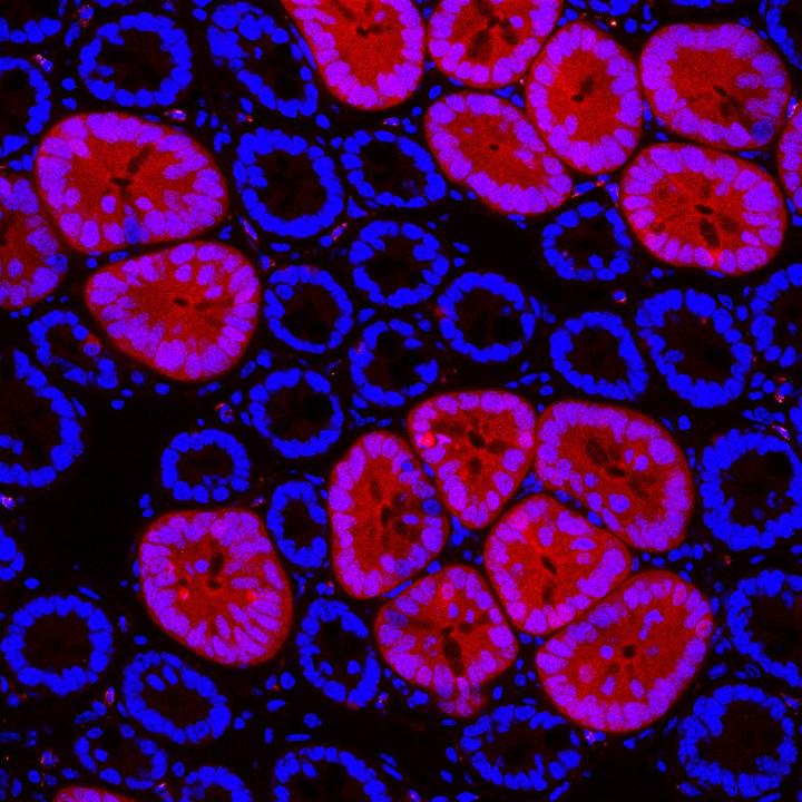 Red2Onco confocal microscopy 2
