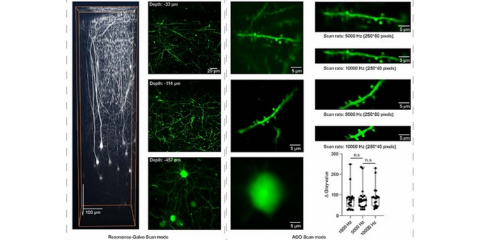 By combining two laser scanning modes, researchers have developed a versatile two-photon microscopy system that can be used to observe extremely fast biological processes at high frame rates and spatial resolution. Credit: Li et al., doi 10.1117/1.NPh.10.2.025006