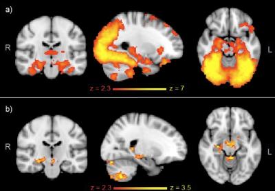 FMRI Analysis of Brain Network Activity While Carrying Out a Memory-Related Task
