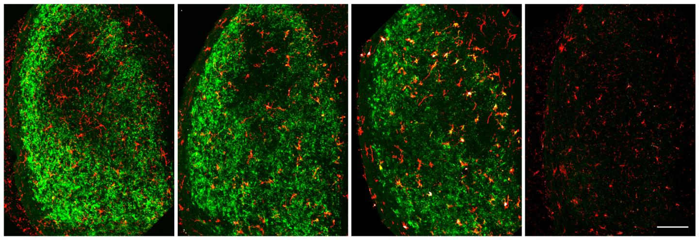Microglia Clear Away Neuronal Debris After Nerve Injury