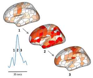 Brain graphic