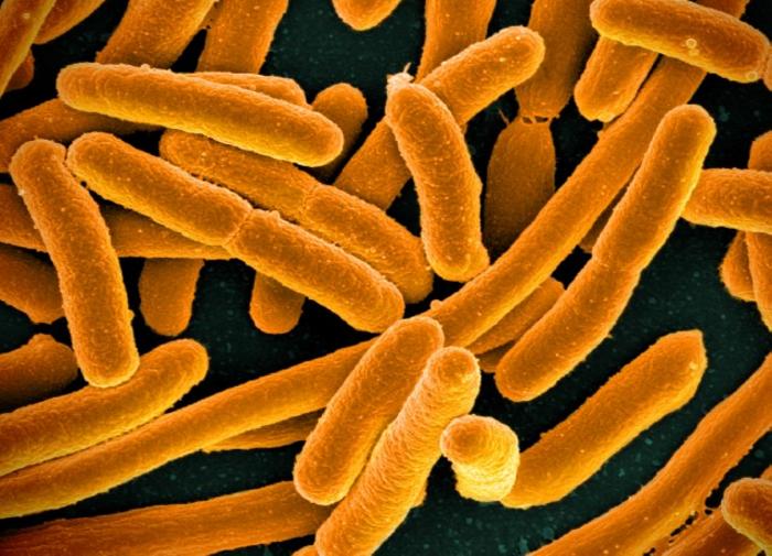 E.Coli