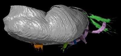 <i>Pauline avibella</i> Right Lateral View