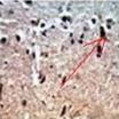 Caspase-3 Expression