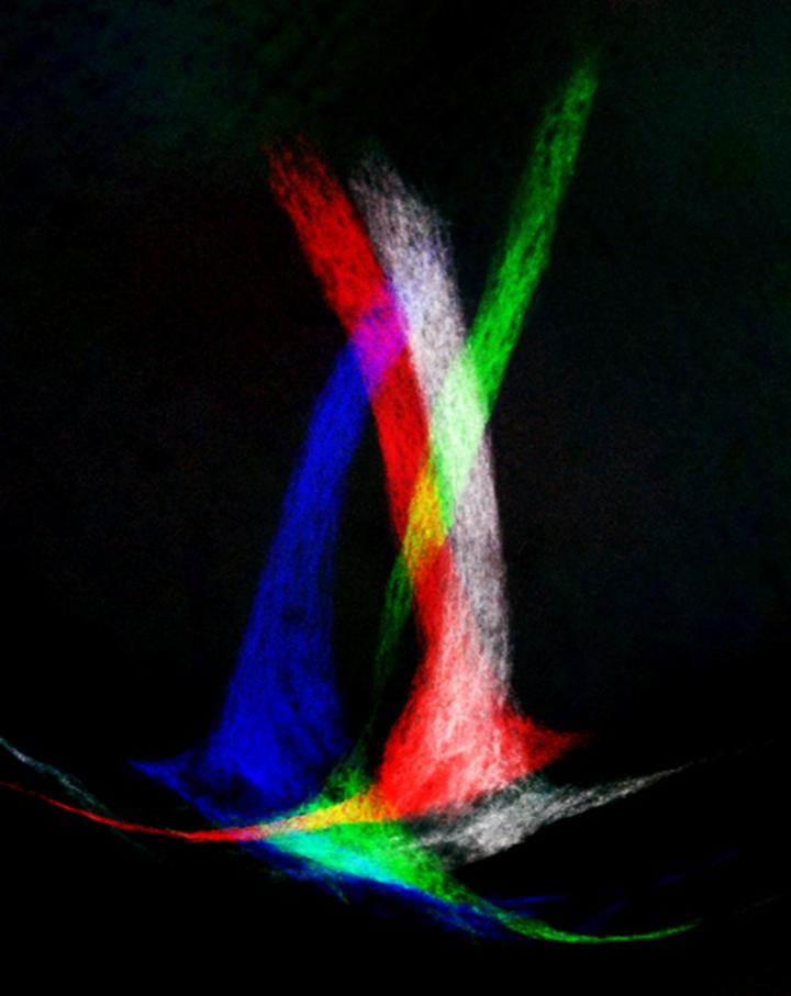 Innervated Medial Terminal Nuclei