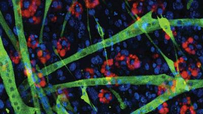 Muscle Regeneration in Duchenne Muscular Dystrophy