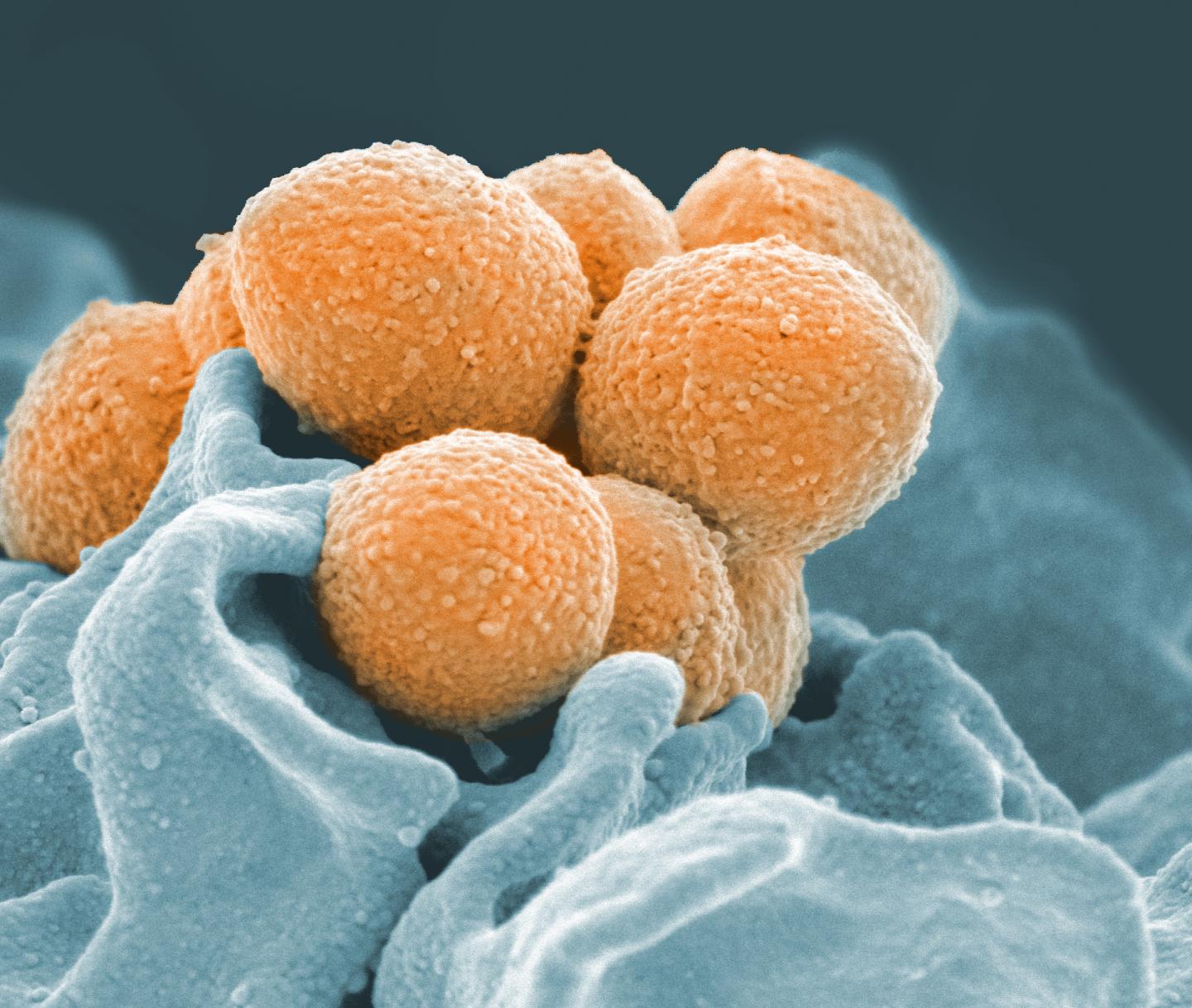 Scientists Identify a Mechanism of Epidemic Bacterial Disease