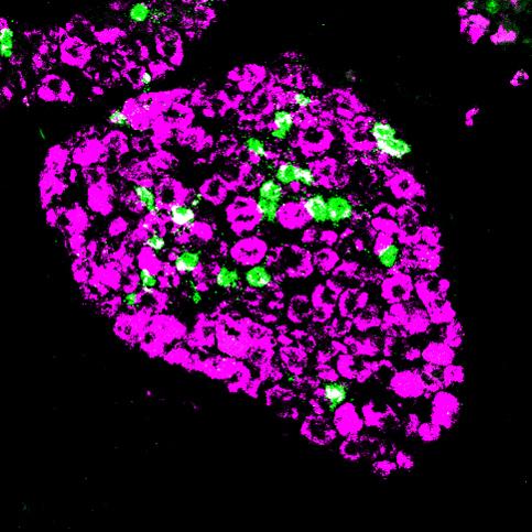 Nerves Involved in Detecting An Itch and Sensing Pain