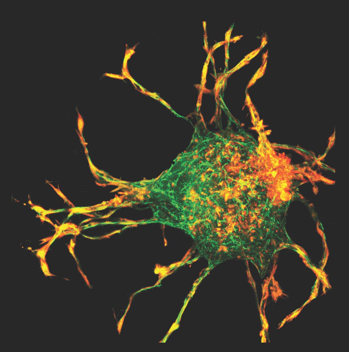 Fibroblast Morphology in 3D with No Actomyosin Contractility