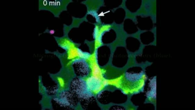 Microglia Consume Live Photoreceptors in RP