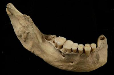 Lower Mandible