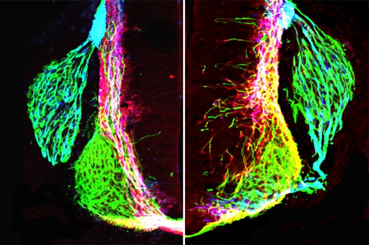 Netrin1 Influence on Axon Growth