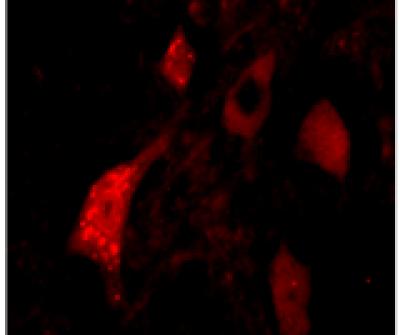 New Therapy Offers Hope to Spinal Muscular Atrophy Patients