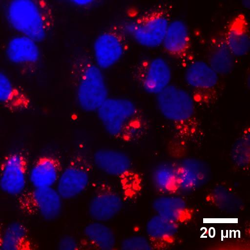 HeLa Cells with Titanium Dioxide Nanoparticles