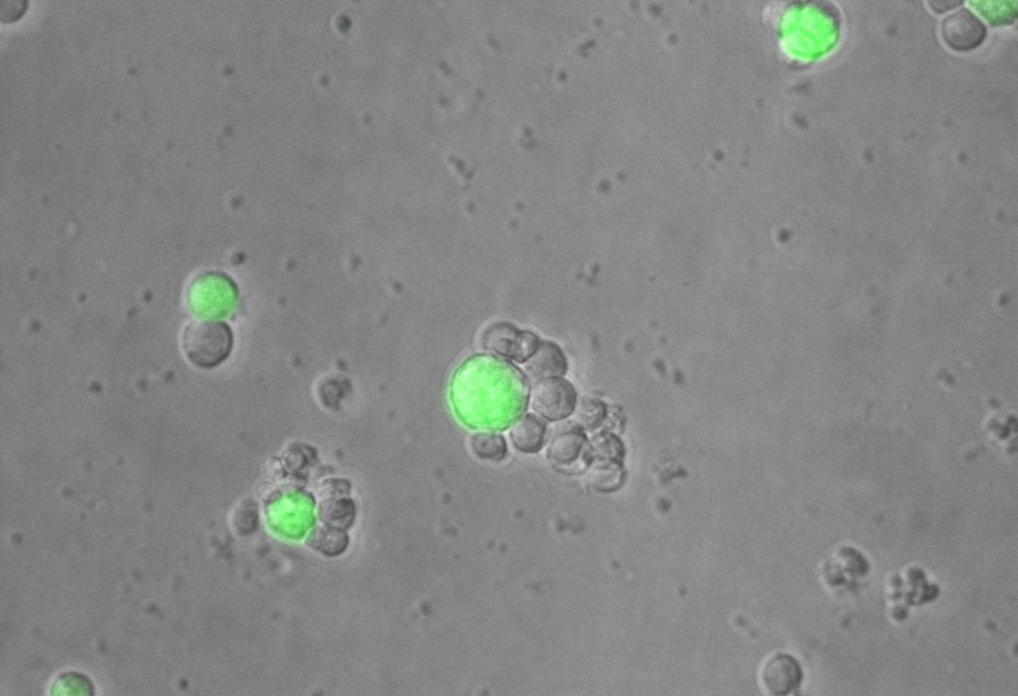 T Cells Attacking Tumors