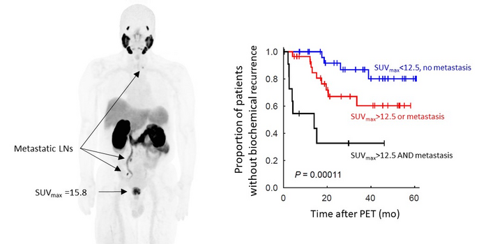Presence of metastatic disease on 68Ga-PSMA PET is associated with earlier biochemical recurrence.