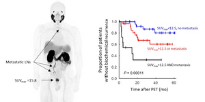 Presence of metastatic disease on 68Ga-PSMA PET is associated with earlier biochemical recurrence.