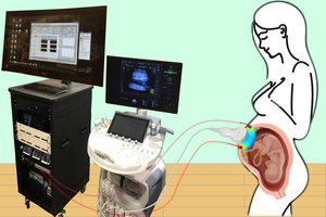 Imaging the placenta