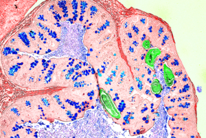 Preclinical model of intestinal parasitic infection.