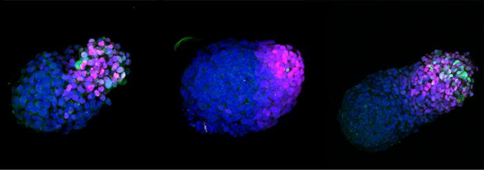 A growing human gastruloid - a type of embryo model