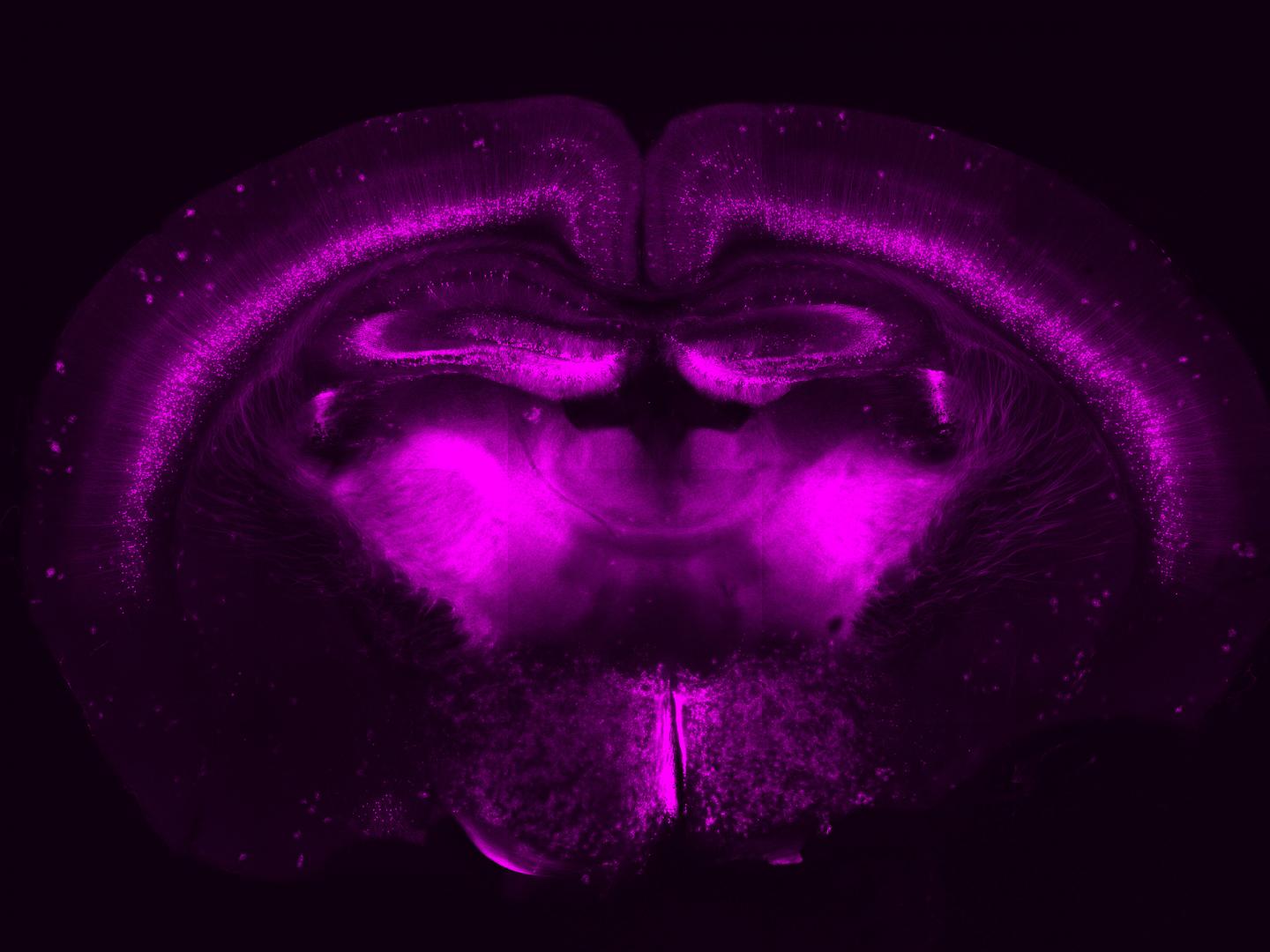 Subset of Neurons Tagged with CRISPR-Cas9