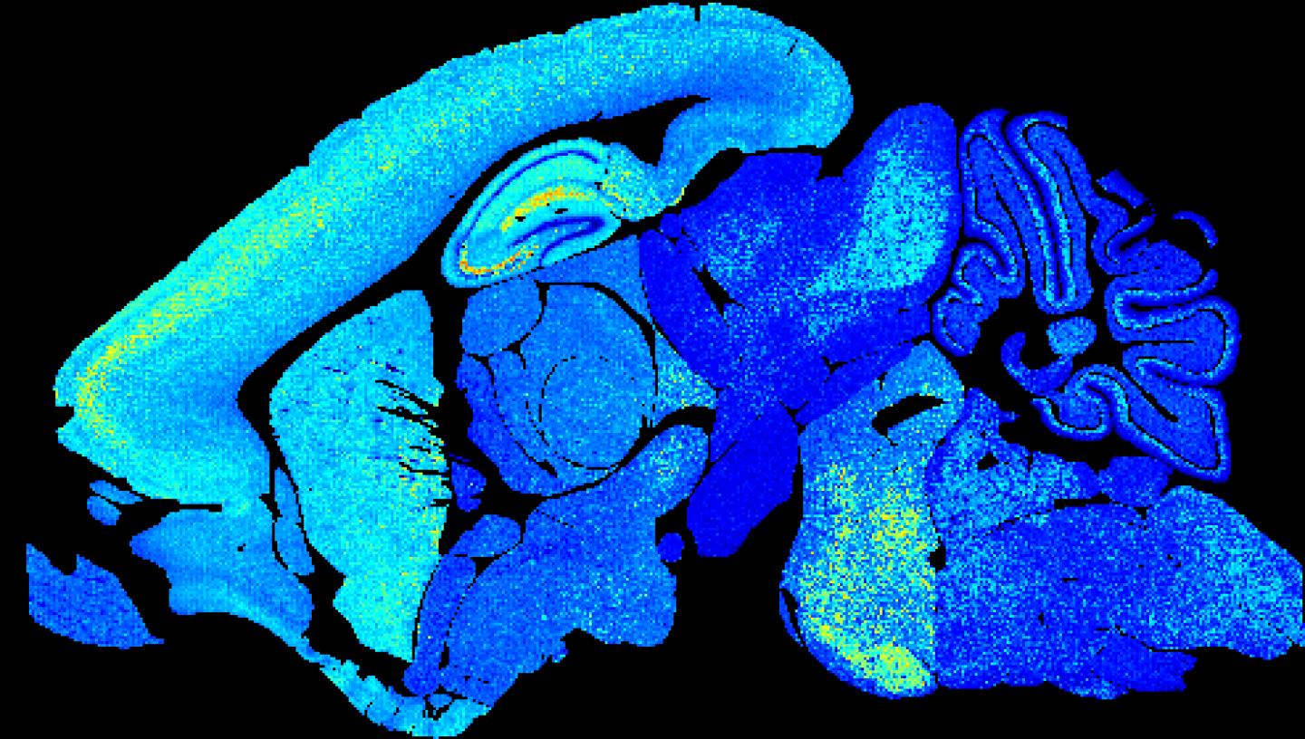Young mouse brain section showing lower synapse diversity.