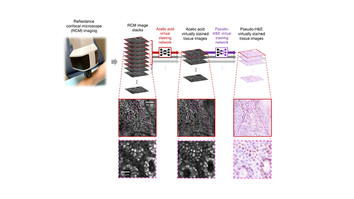 Biopsy-free in vivo virtual histology of skin using deep learning.