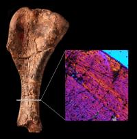 Upper Arm Bone and Colorized Scan of Bone Tissue