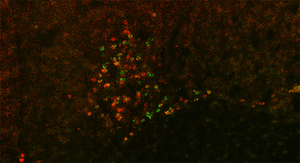 Scripps Research scientists hunt for neurons responsible for alcohol withdrawal