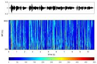 Speech Signal and its Transformation into the Reaction of the Auditory Nerve