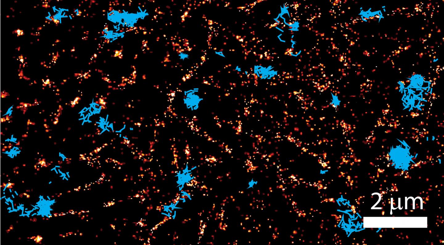 Actin and Cell Membrane