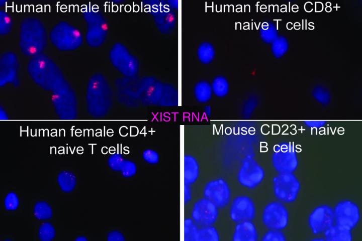 Unusual pPtterns of X Chromosome Inactivation in Immune Cells