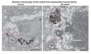 Dark Microglia