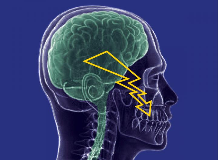Trigeminal Neuralgia