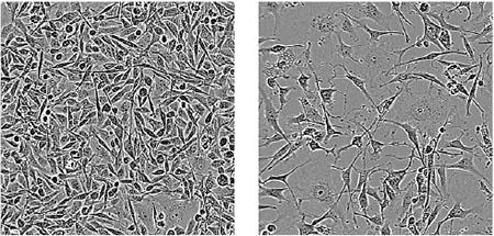 Breast Cancer Cells