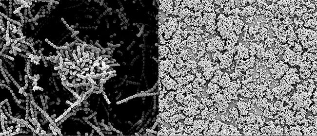 Strep Biofilm Breakdown by Human Milk Oligosaccharides
