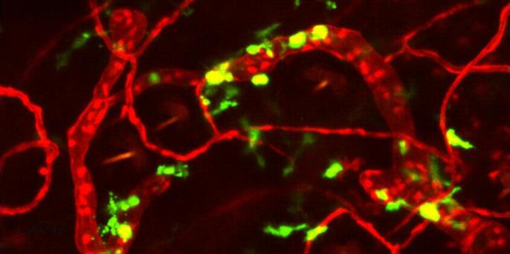 Dendritic Cells within Lymphatic Capillaries