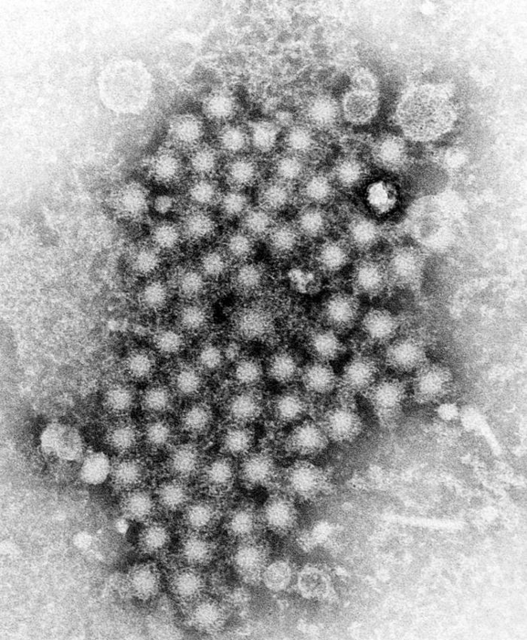 A transmission electron microscopic image of hepatitis virus particles