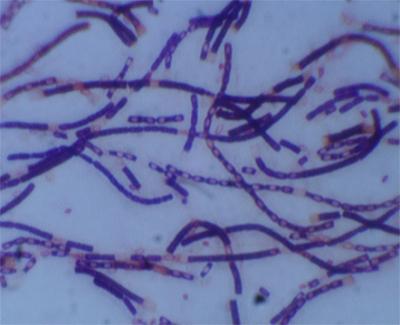 <i>Bacillus anthracis</i>