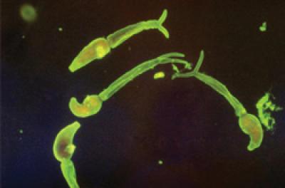 <i>Schistosoma mansoni</i>